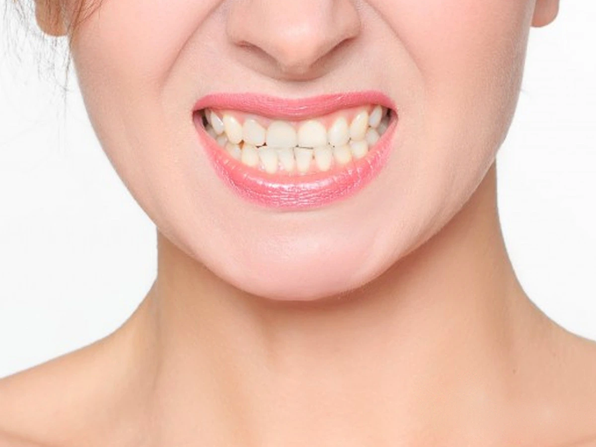 Bruxismo – o que há de novo?