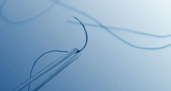 Importância da sutura e o que fazer após uma extração dentária