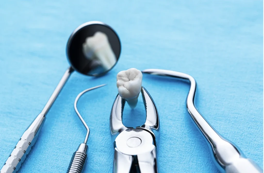 extração dentária