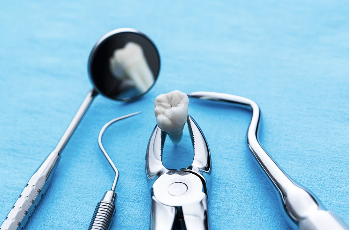 Extração dentária: cuidados a ter